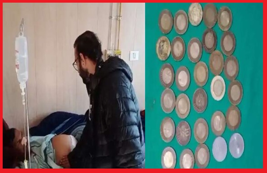 हिमाचल में युवक ने पेट को बना डाला गुल्लक;ऑपरेशन से निकाले 247 ग्राम वजन के 33 सिक्के  
