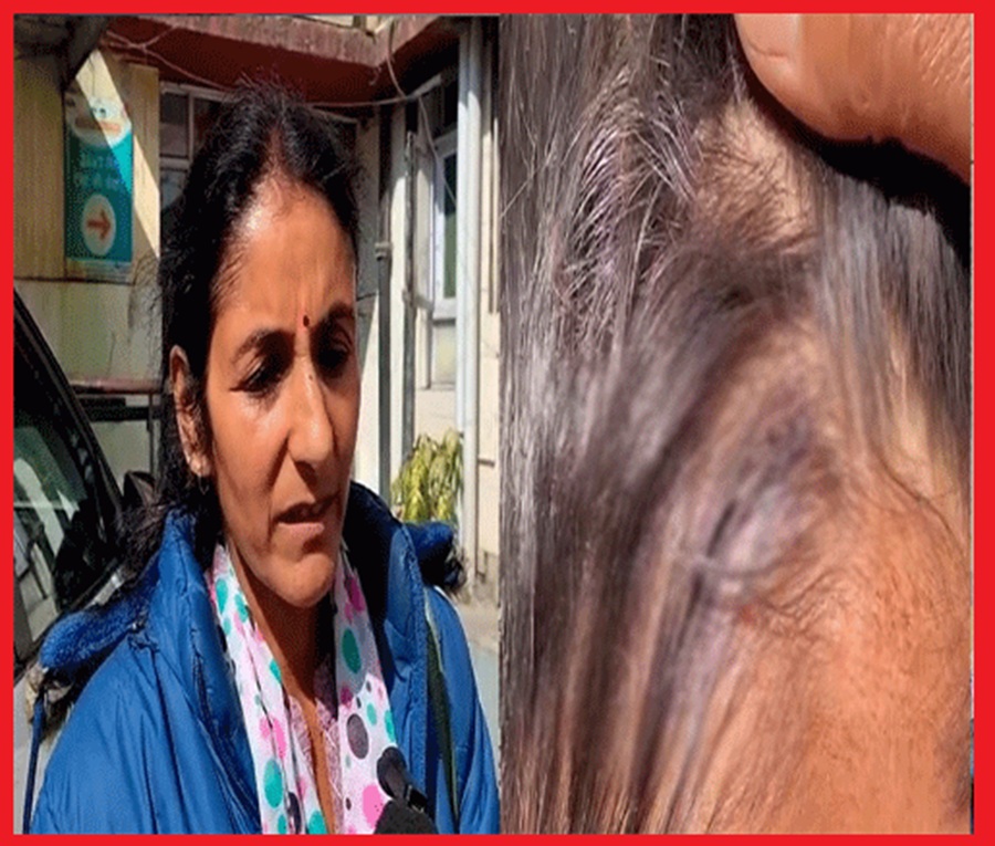  अध्यापक पर स्कूल में लोहे के स्केल से बच्चे की पिटाई करने के लगे गंभीर आरोप