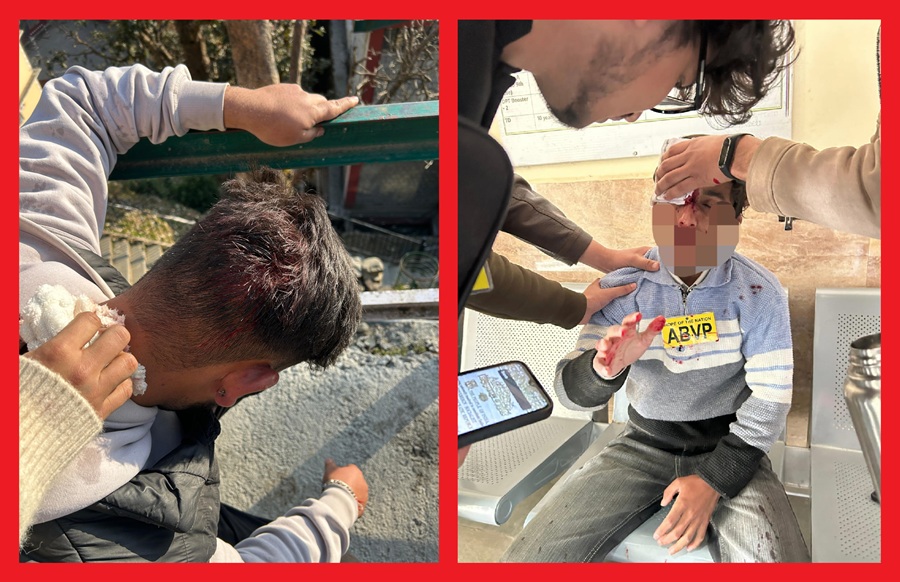 एचपीयू परिसर में छात्र हिंसा का गंभीर मामला — अभाविप कार्यकर्ताओं पर सुनियोजित हमला, कड़ी कार्रवाई की मांग